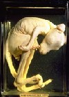 MacKenzie wet specimen - a kangaroo foetus